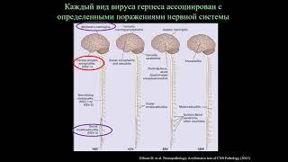 Герпетический энцефалит и другие поражения нервной системы, вызванные альфа-герпес-вирусами