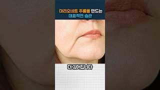 입가주름 가장 쉽게 없애는 방법!ㅣ강남 성형외과 원장의 꿀팁