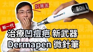 治凹痘疤，新武器 Dermapen (得美)微針筆，第四代微針筆，治療凹痘疤快速又方便！