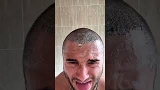 Get some finasteride lads - DAVE55 on Manual
