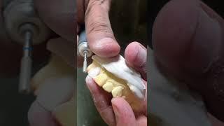 Porcelain crown making #umairtoothfairy #dental#satisfying #shorts #viral #umairazeem@Umairazeem8553