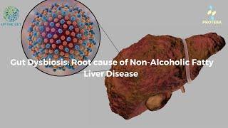 Gut Dysbiosis & Non Alcoholic Fatty Liver Disease: The real connection