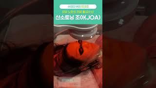 우주인토닝 산소토닝조아JOA