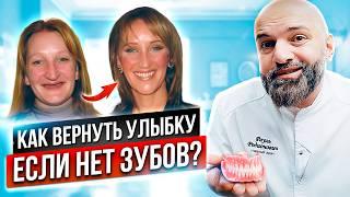 Что делать, если не осталось ни одного зуба во рту? Импланты на все зубы.  4 способа протезирования