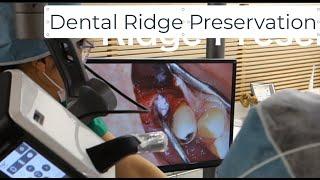 Ridge preservation with the Mielscope dental microscope