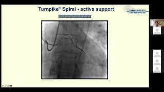 Active support Turnpike spiral