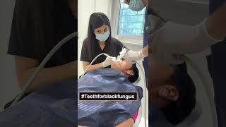 Zygomatic Implants & Tooth Fixing After Black Fungus | Seraphic Dental