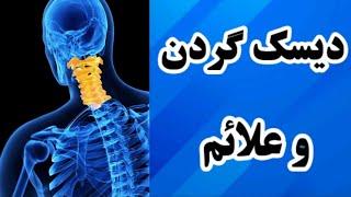 دیسک گردن و علائمی که نادیده میگیریم / دکتر نکته