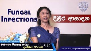 Fungal Infections (දිලීර ආසාදන) - Dr. Surammika Eriyagama, Consultant Dermatologist #skincare