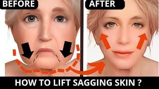 ANTI-AGING EXERCISES FOR SAGGING SKIN, SAGGY CHEEKS, JOWLS, LAUGH LINES, FOREHEAD, FROWN LINES