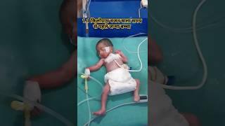 Preterm baby boy with 1.1 kg weight | नवजात शिशु का वजन 1100 ग्राम है | #viralshorts  #viralvideo