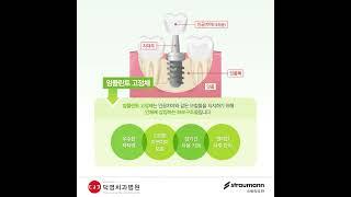 스트라우만 올치(all齒)캠페인 #3 임플란트 이해하기 [대구 덕영치과병원]