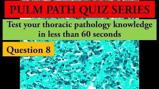 Test your thoracic pathology knowledge in less than 60 seconds. Question 8