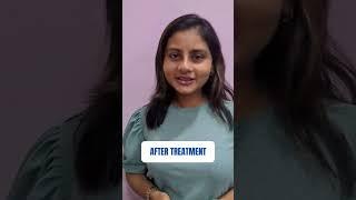 Nose & lip Filler Treatment | PMU | Kolkata | #youtubereels #youtubeshorts #youtubevideo