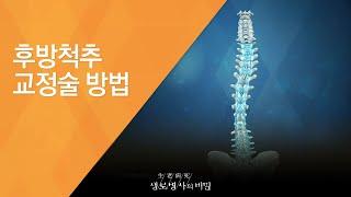 후방척추 교정술 방법 - (20150408_541회 방송)_틀어지고 휘어진 허리 ‘척추측만증’