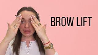 Brow lift (Laminiranje obrva) - sve o tretmanu