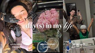 DAY(S) IN MY LIFE |25 yr old mom| lip filler appt, grocery haul, green juice recipe, gym, etc! 