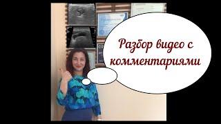 Тренировочное видео для продвинутых докторов (средний уровень) разбор с комментариями