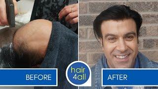 How to Apply (Attach) a Non-Surgical Hair Replacement System for Men with our Client