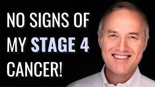 My STOMACH CANCER Was Found By Accident! - Jeff | Stage 4 Stomach Cancer | The Patient Story