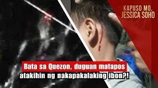 Bata sa Quezon, duguan matapos atakihin ng nakapakalaking ibon?! | Kapuso Mo, Jessica Soho