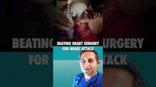 Beating Heart Surgery For Heart Attack Under Anesthesia (#Shorts)