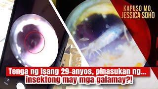 Tenga ng isang 29-anyos, pinasukan ng insektong may mga galamay?! | Kapuso Mo, Jessica Soho