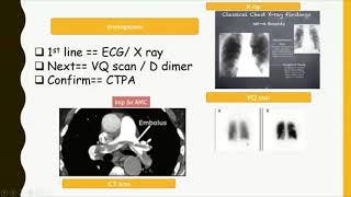 AMC recalls part 1 | AMC latest recalls| AMC study Materials | AMC MCQ preparation Course