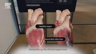 Complete HeartX – discovering the ins and outs of a myocardial infarction