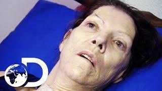 Miracle Drug Wakes Up Woman In A Coma After 2 Years | My Shocking Story