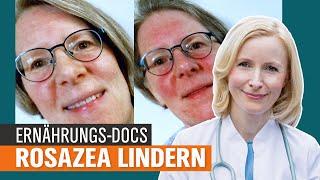 Rosazea erkennen und heilen: Was hilft bei Entzündungen im Gesicht? | Die Ernährungs-Docs | NDR