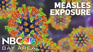 Two Bay Area health agencies warn of potential measles exposure