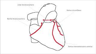 EKG verstehen; Schenkelblock, Herzinfarkt (EKG Crashkurs Teil 2)