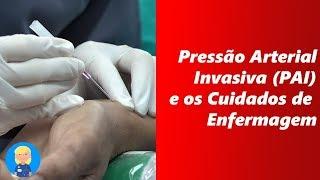 Pressão Arterial Invasiva (PAI) E os Cuidados de Enfermagem