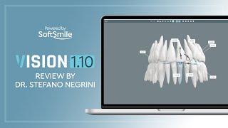 VISION 1.10 Review by Dr. Stefano Negrini