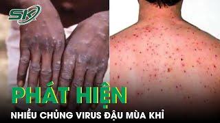 Chủng Virus Đậu Mùa Khỉ Ở Ấn Độ Không Giống Ở Châu Âu | SKĐS