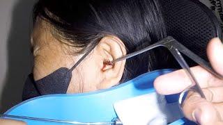 Something Trapped & Stuck for Days Removed from Woman's Ear