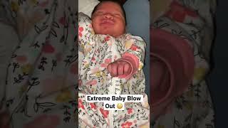 My daughter has an extreme baby blowout #baby #blowout #funnybabyvideos #shorts