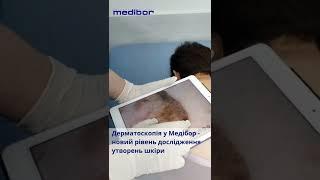 Цифрова дерматоскопія у Медібор