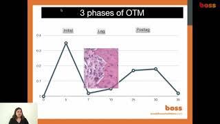 Lecture: Cellular basis of orthodontic tooth movement PLUS speeding tooth movement