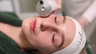 ENDOSPHERES FACE LIFT | OBLIQUE BEAUTY HOUSE