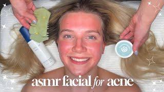 ASMR Relaxing Facial for Acne