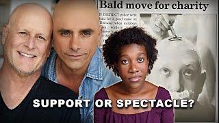 The TRUTH About Head Shaving For Cancer Solidarity