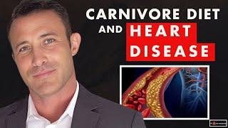  Can You Develop HEART DISEASE On The Carnivore Diet? 