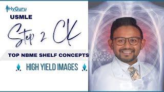 Top NBME Images (Radiology) | USMLE Step 2 CK 🩻