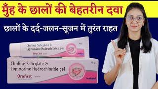 Orafast gel for mouth ulcers || Choline Salicylate & Lignocaine Hydrochloride mouth gel छाले की दवा