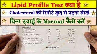 How to Read Lipid Profile Test Report | What is Cholesterol | How to Normal Cholesterol ?