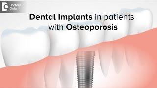 Can I get dental implants if I have osteoporosis? - Dr. Ranjani Rao | Doctors' Circle