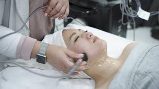 Forma for Skin Tightening Cheeks and Jaw | Profile Laser & SkinCare in Richmond BC