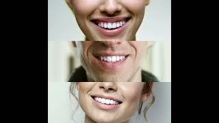 All smiles with whiter teeth! Save up to 50%!